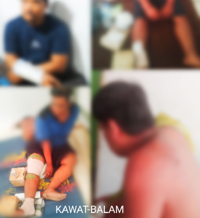 Tembok Runtuh Timpa Bangunan Dan Warga, Perusahaan Stockpile Batubara Diduga Tutup Mata