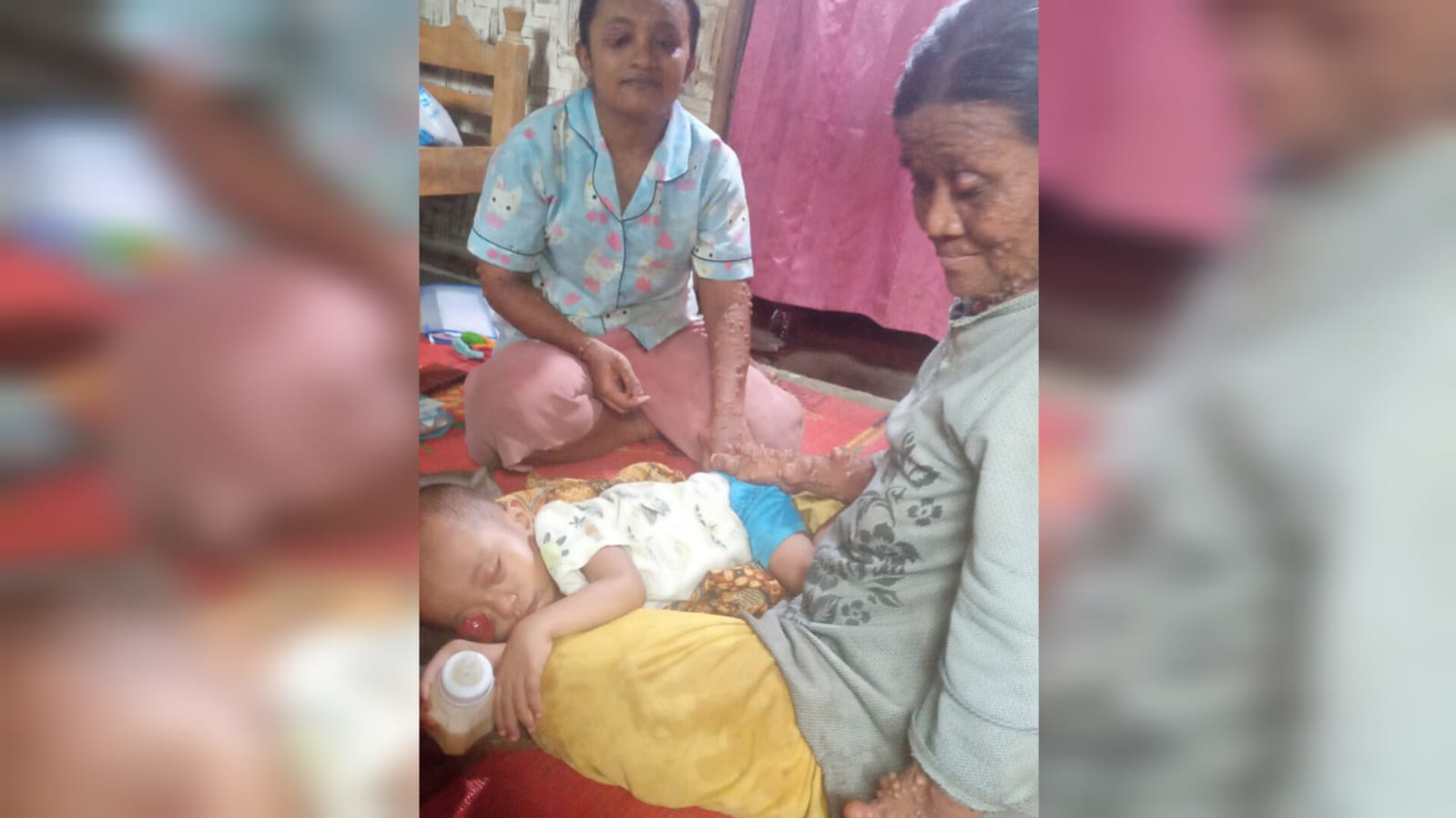 Forum Komunikasi LKS Lampung Assessment Balita Tumor Mata di Pesawaran