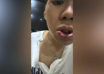 22 Hari Tak Ada Kepastian, Ayah Korban Penganiayaan Datangi Polsek Tanjungkarang Timur