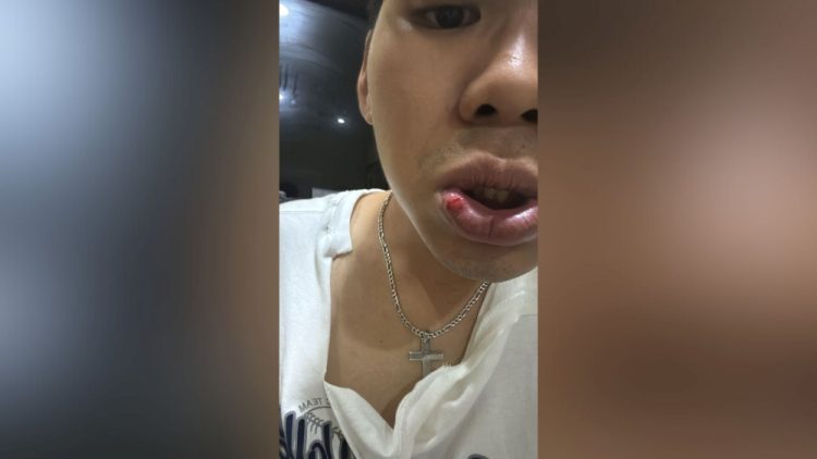 22 Hari Tak Ada Kepastian, Ayah Korban Penganiayaan Datangi Polsek Tanjungkarang Timur